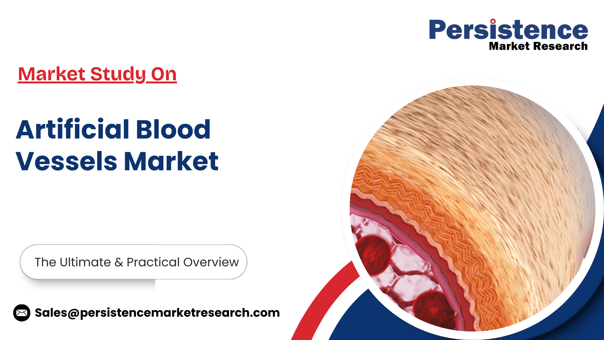 記事コンテンツ画像