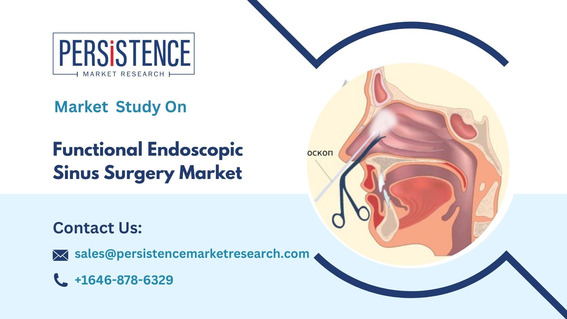 記事コンテンツ画像