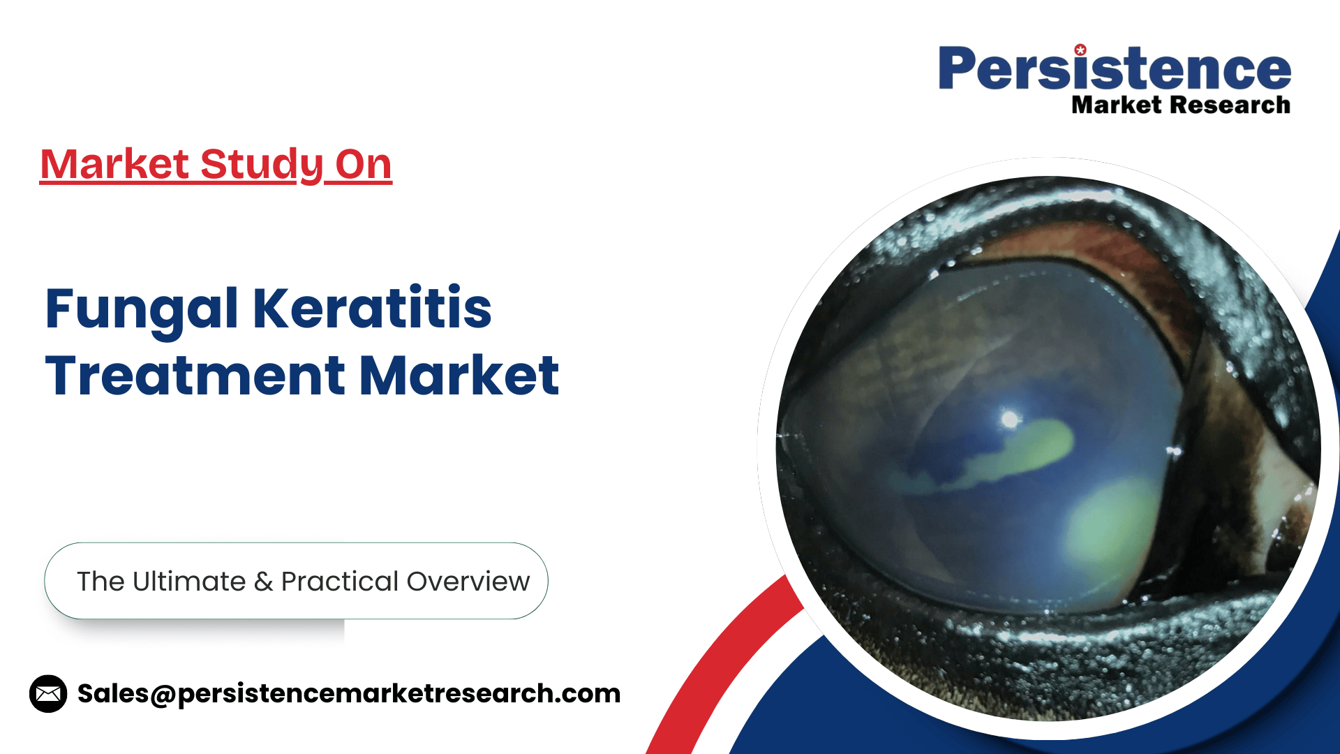 記事コンテンツ画像