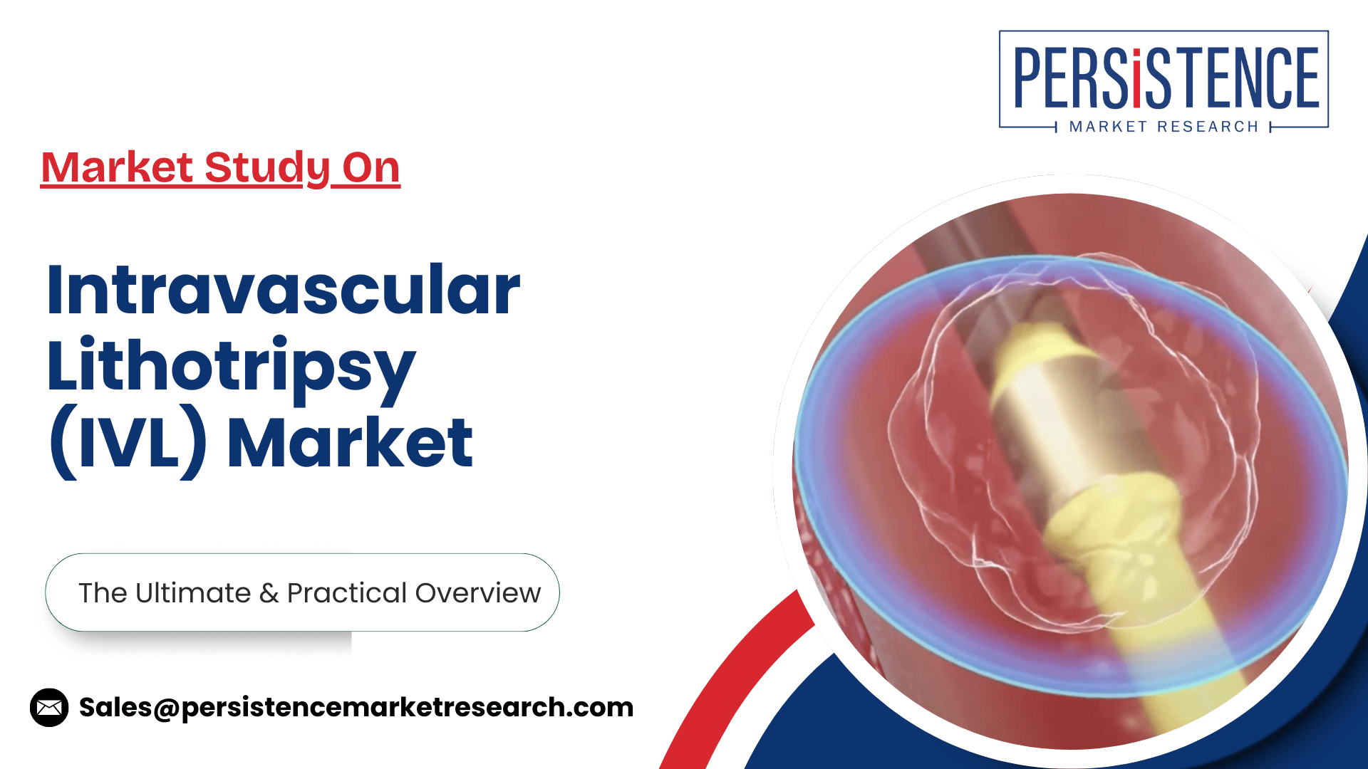 記事コンテンツ画像