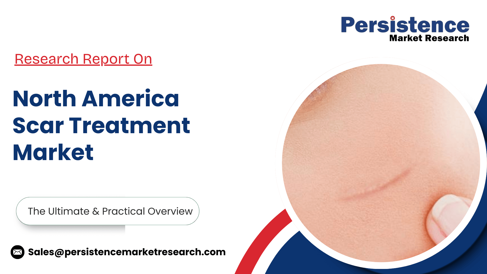 記事コンテンツ画像