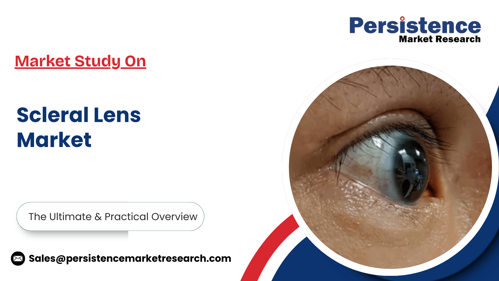 記事コンテンツ画像