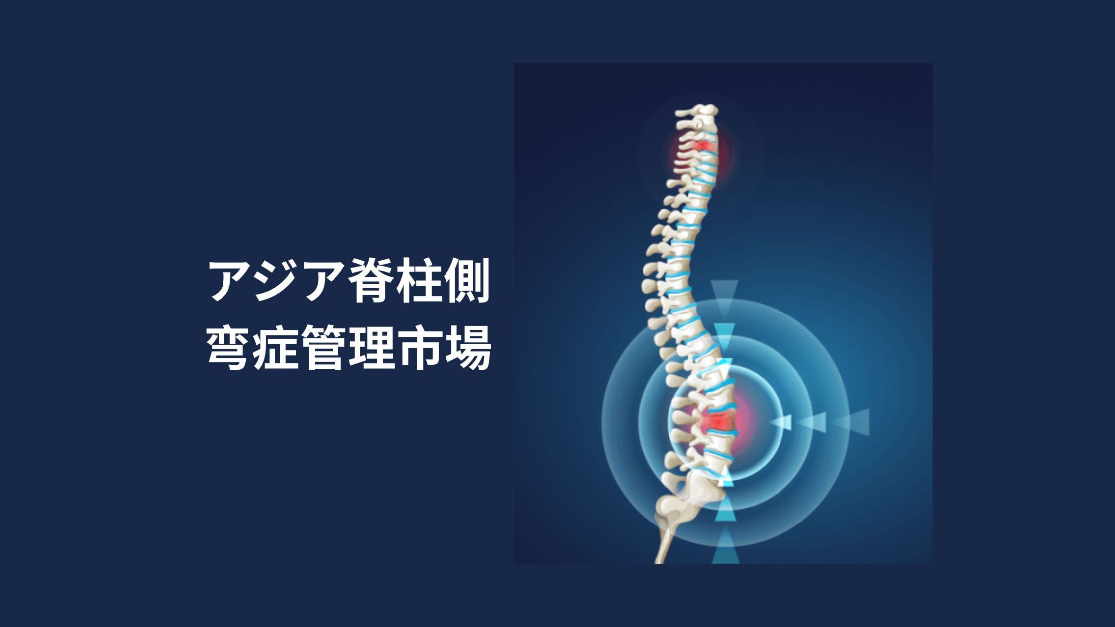 記事コンテンツ画像