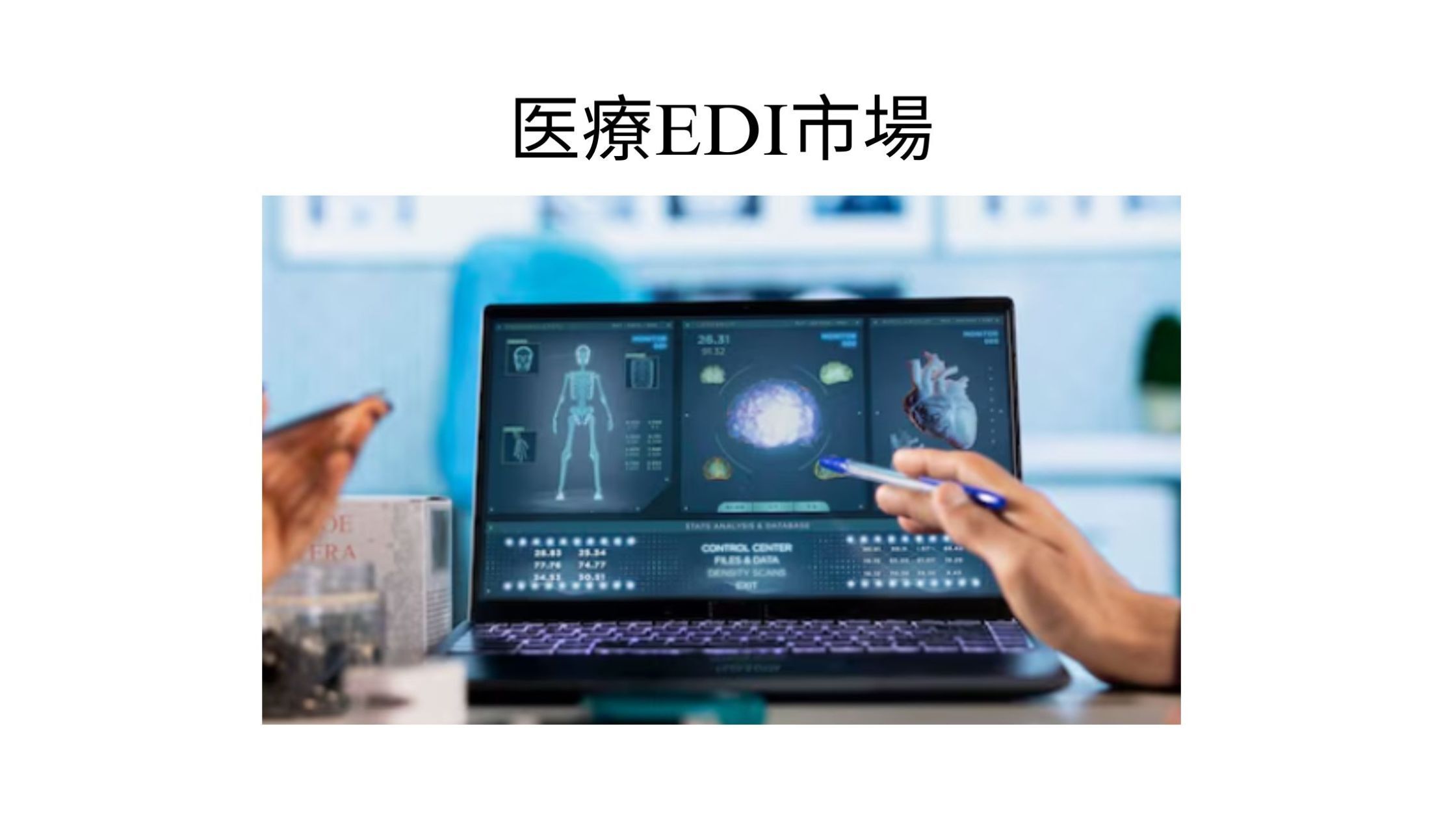 記事コンテンツ画像