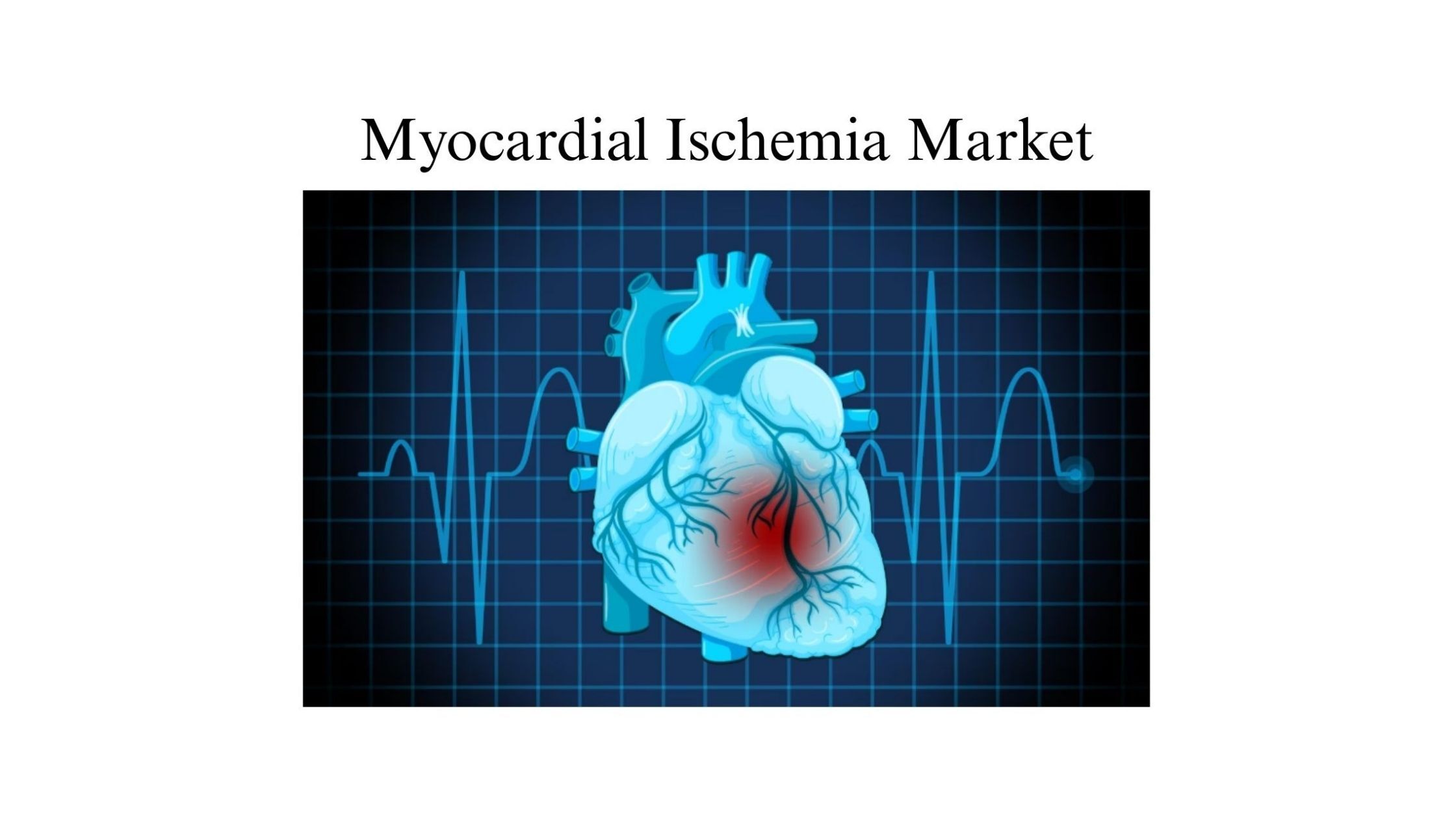 記事コンテンツ画像