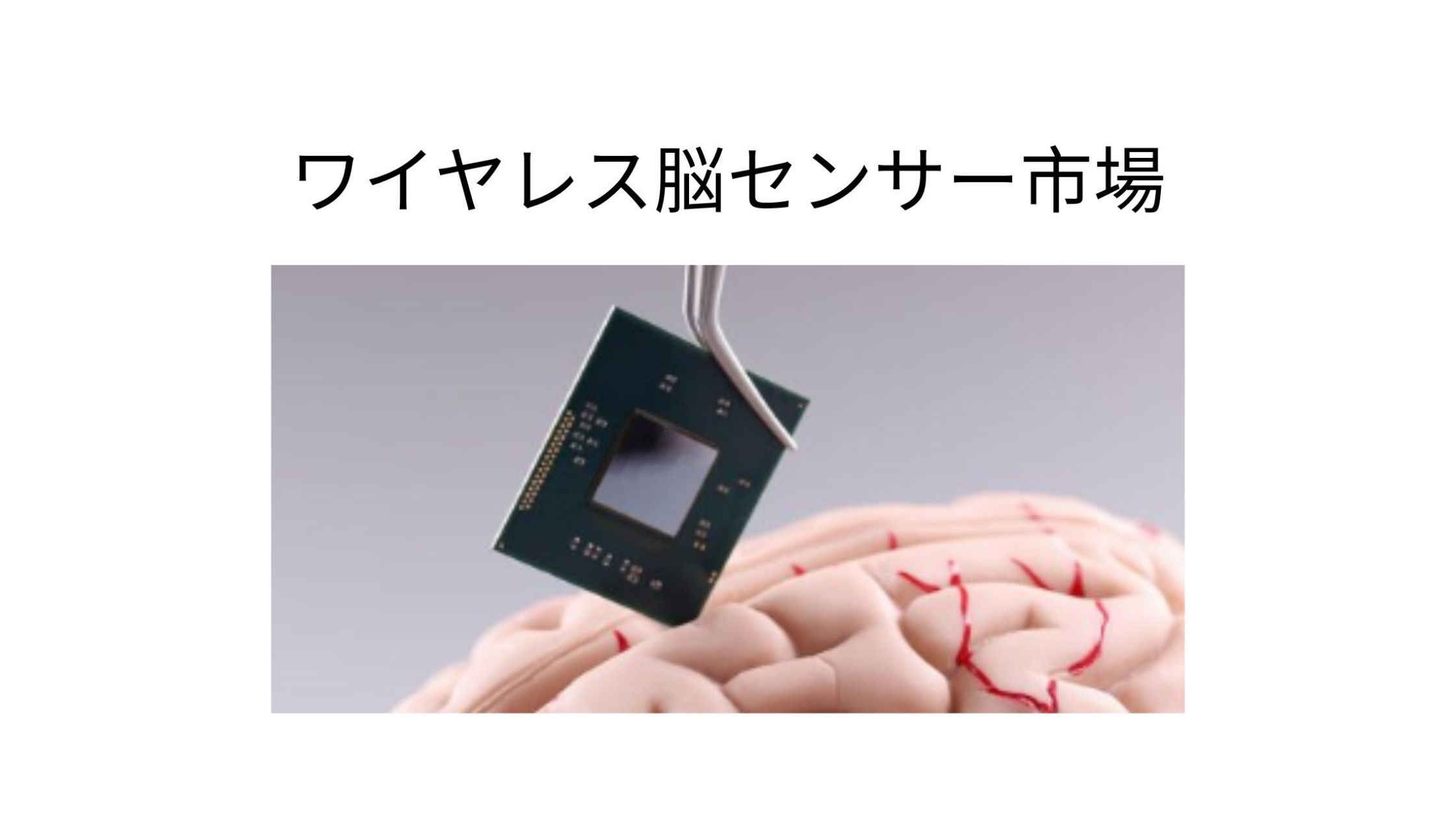 記事コンテンツ画像