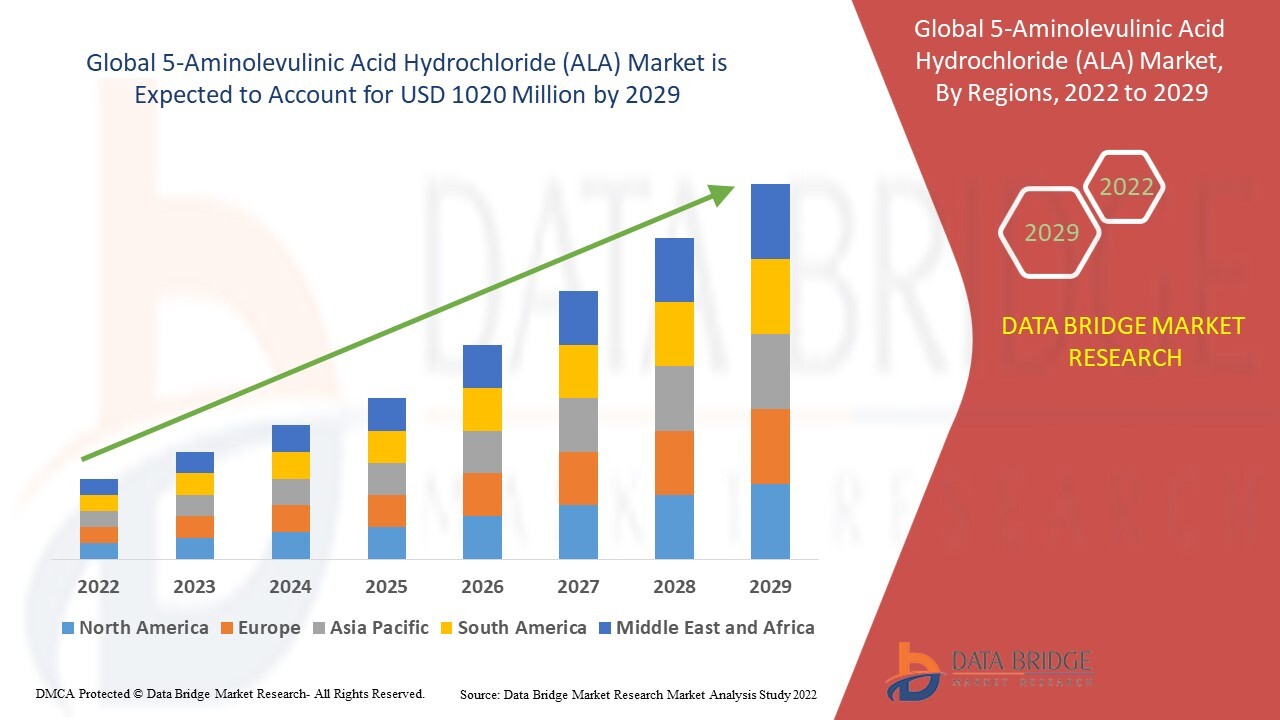 記事コンテンツ画像