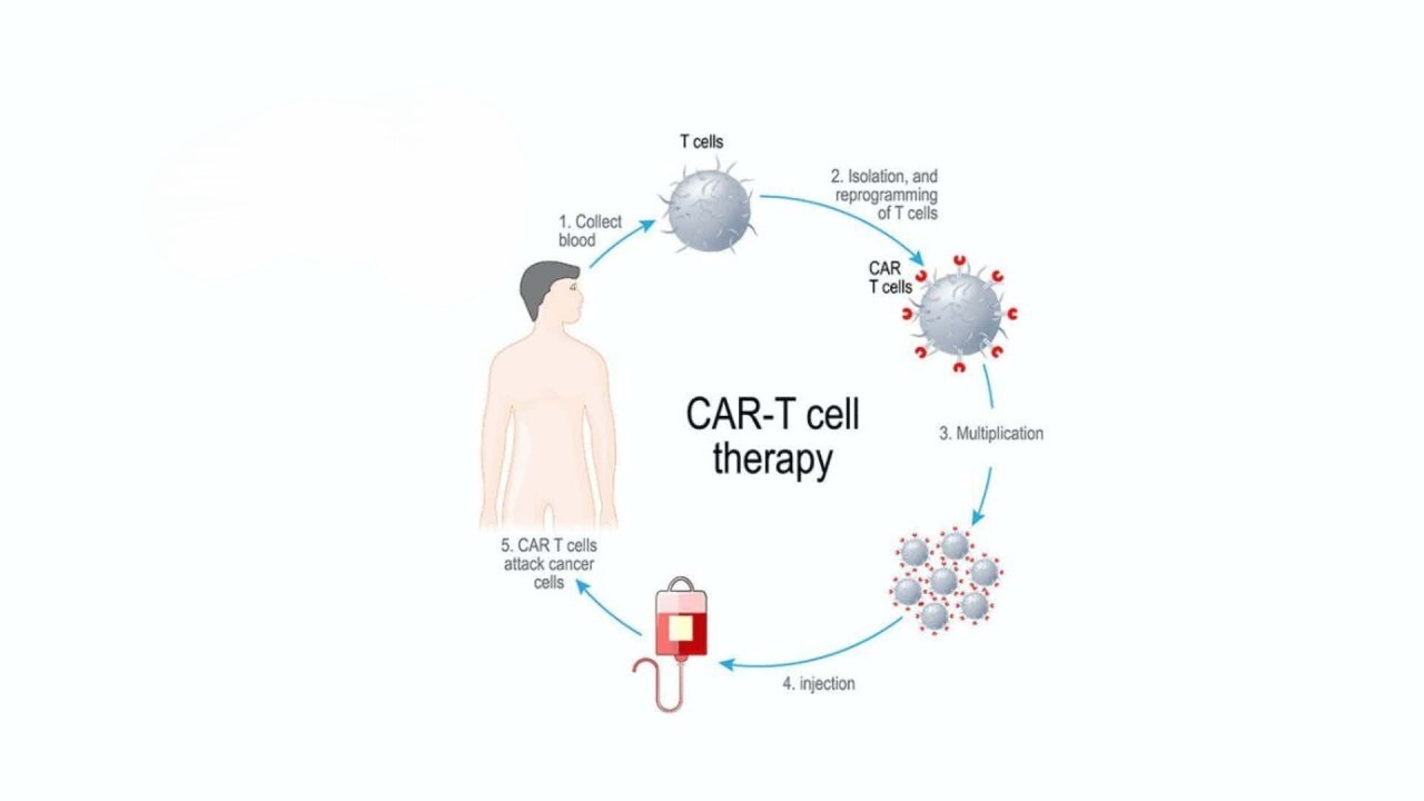 記事コンテンツ画像